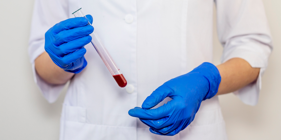 Profissional de saúde segurando tubo de sangue