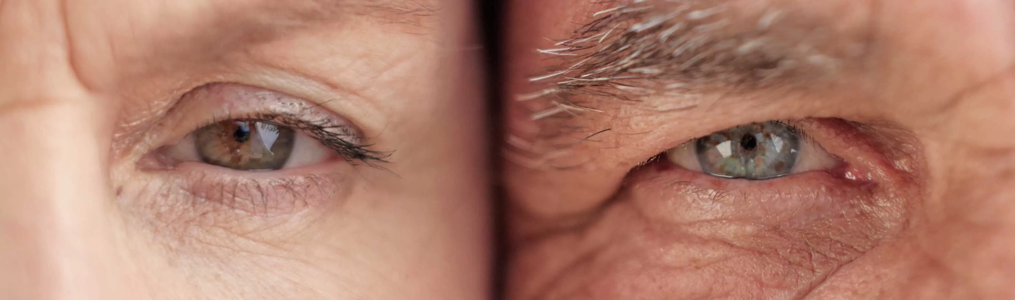 Dois olhos de cores diferentes