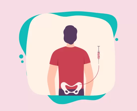 Desenho de homem coletando medula óssea