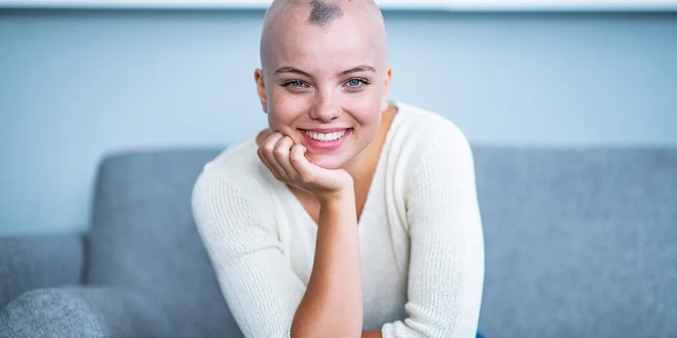 mulher com calvície apoiada em uma mão