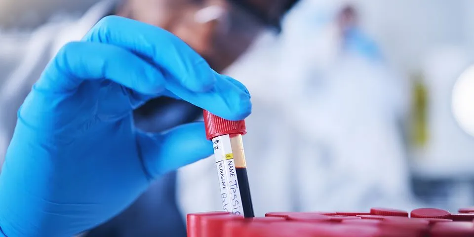 Tubo de Sangue